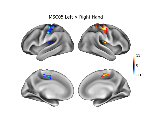 MSC05 Left > Right Hand